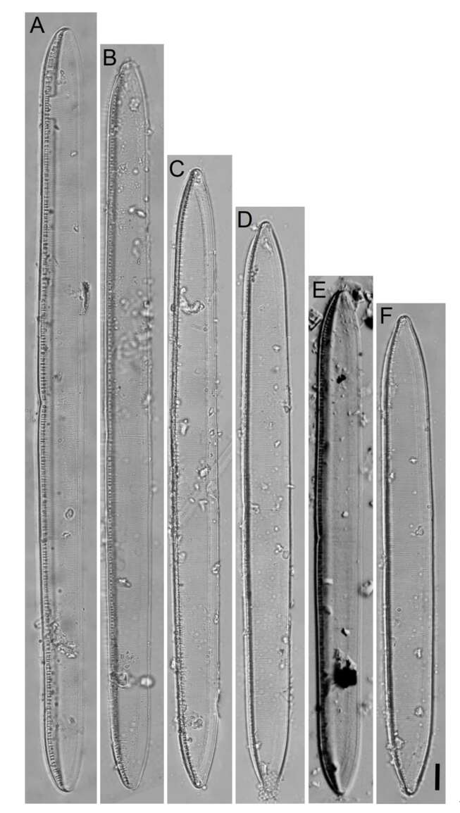 崇明盘杆藻（Tryblionella chongmingensis）封片光学显微照片。上海海洋大学供图