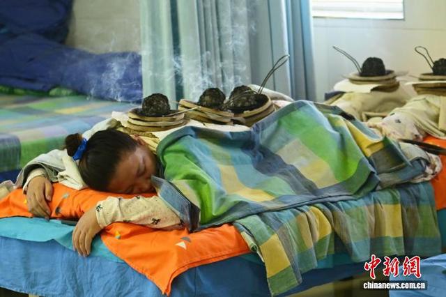 图为8月12日患者在敦煌市中医医院体验敦煌壁画“艾灸图”中的艾灸。中新社记者 李亚龙 摄